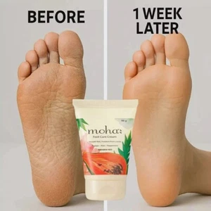 Foot Cream Heel Cracked Repair Cream Removal Dead Skin Moisturizing 50gm - Picture 1 of 8