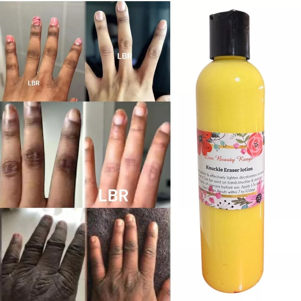 BORRADOR DE NUDILLOS OSCUROS/PIES/LOCIÓN DE CODO DE ACCIÓN RÁPIDA TONO UNIFORME CLARO, 7 días 6 oz👌 Foto 1 de 4