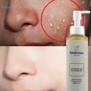 LACTOBIONIC ACID EXFOLIATING GEL RADIANT SKIN 150ML - Picture 1 of 4