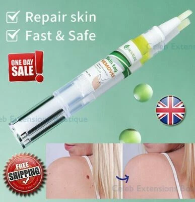 SAUVASINE Wart Removal Treatment Liquid Pen's🌟 Painless Spot Mole Skin Tag ✅2x3ml Pens!