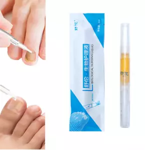 Pluma para hongos de uñas de los pies Okita, pluma anti hongos de uñas Okita, reparación de uñas - Imagen 1 de 7