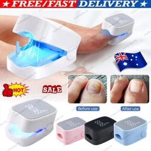 Anti Fungal Laser Device,Nail Fungus Treatment Device,Fast-acting Home Treatment - Picture 1 of 22