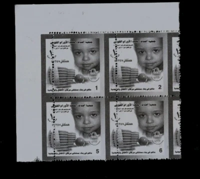 INSTITUTO NACIONAL DEL CÁNCER EGIPTO INGRESOS 2 ENSAYOS ENSAYOS BLOQUES MAL PERFORADOS MN Foto 1 de 2