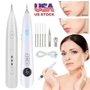 Laser Plasma Pen Facial Body Mole Removal Dark Spot Skin Tag Tattoo Wart Remover - Picture 1 of 21