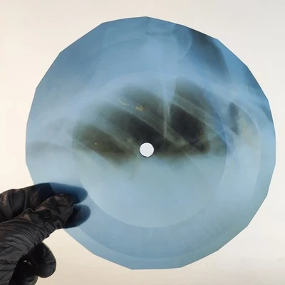 BOB DYLAN ALL I REALLY WANNA DO X-Ray USSR Record Roentgen Bone Ribs Music Vinyl - Image 1 of 2