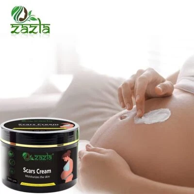 Best Scar Removal-Cream for Old-Scars Stretch Mark Removal Cream UNISEX 100gm - Image 1 of 4