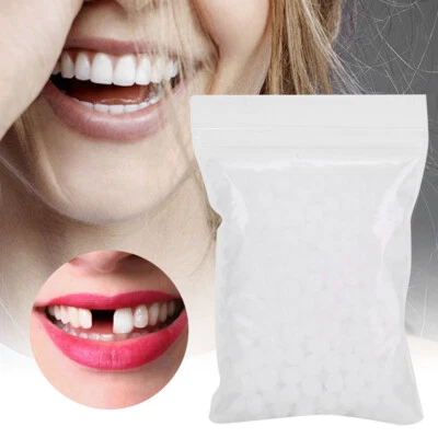 Thermal Beads Teeth Veneers Temporary Tooth Repair Kit for Missing - Image 1 of 4