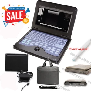 CE CMS600P2 Ultrasound Scanner laptop Machine 6.5M transvaginal Probe for human - Picture 1 of 12