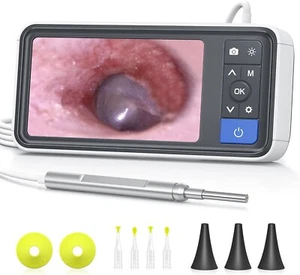 Otoscope Ear Camera with 4.5" IPS Screen, 1920x1080 FHD Smart Visual Ear Wax Rem - Picture 1 of 8