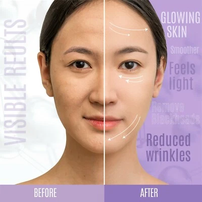 Firming,Wrinkle Remover Matrixyl 3000, Peptide Boost, Hyaluronic Acid Face Serum - Image 1 of 4