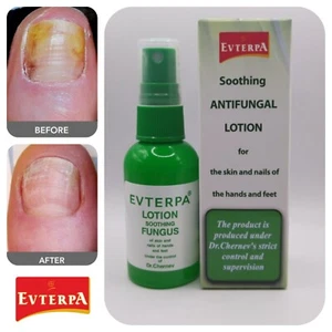 Tratamiento de uñas antihongos pie dedo cuidado de uñas reparación 99,9% 50 ml - Imagen 1 de 12