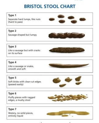 Bristol Stool Chart Poster, Health Poster, Healthy Poop, Medical Laboratory - Image 1 of 4
