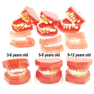 Dental Pediatrics Teeth Model Children 3-12 Year Old Permanent Alternate Model - Picture 1 of 12