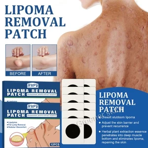 12 Sheet Lipoma Entfernung Patch Herbal Organic Lipolyse Fett Schmerzlinderung - Bild 1 von 10