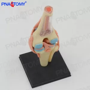 Detachable Knee Joint Anatomy Model Medical Science and Education Model - Picture 1 of 9