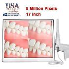 17 Inch Dental Intra Oral Camera WIFI High-Definition Digital AIO Monitor US