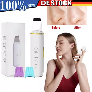 Ultraschall Skin Scrubber Ultraschallpeelinggerät für Gesicht Gesichtsreinigung - Bild 1 von 10