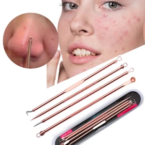 Needle For Spot Acne Pimple Blackhead Remover Tool Kit Comedone Extractor Popper - Picture 1 of 22