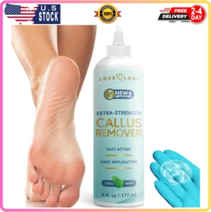 Foot Callus Remover Gel 6Oz - Callus Remover for Feet & Dead Skin Pedicure Home - Picture 1 of 8