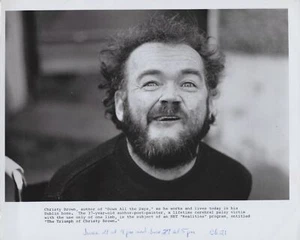 PBS 1969 Christy Brown Down All the Days Dublin Home 10x8 Original Press Photo - Picture 1 of 2