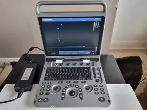 Chison EBit 50 Portable Ultrasound Machine - Picture 1 of 8