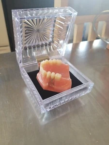 Dental implant typodont model sell implant dentistry to your patients - Picture 1 of 4