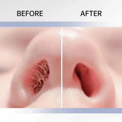 Rasoir Nez Oreilles Double Lame Coupe Poils Manuel Portable Nettoyage Facile ++ - Photo 1/4