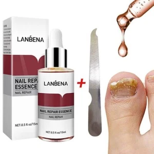 Fungal Nail Essence Repair Serum Nail File Hand&Foot Treatment Nail Repair 1/2*- - Picture 1 of 13