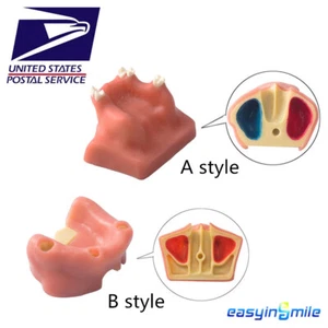 Modelo de diente dental Easyinsmile elevación de senos práctica estudio enseñar modelo estilo A/B - Imagen 1 de 14