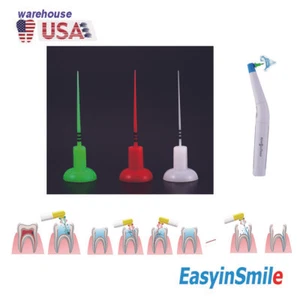 Puntas activador dental Easyinsmile 60 piezas para pieza de mano activador ultrasónico Endo - Imagen 1 de 10