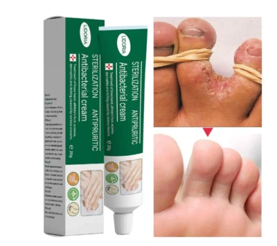 Crema Piedi Anti Piedi 20/40/60g Deodorante Crema Piedi Antibatterica Anti Prurito - Immagine 1 di 4