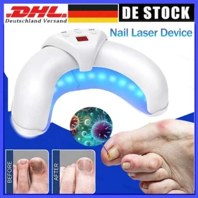 ZREE Nagelpilz Laser Gerät schnelle Reparatur von Zehen Pilz Onychomykose Behandlung