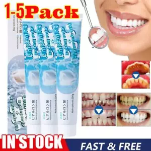 Scoban Whitening Toothpaste, Scoban Whitening Toothpaste, Removes Stains - Foto 1 di 12