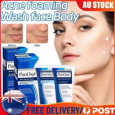 Acne Foaming Cream Face Cleanser 4% Benzoyl Peroxide 10% Maximum Antimicrobial - image 1 of 4