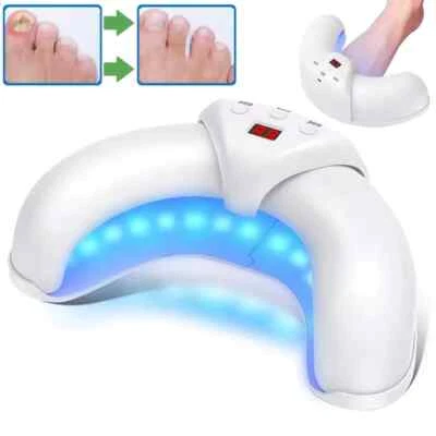 Dispositivo de luz LED para limpieza de hongos en las uñas para reparación múltiple de uñas de los pies onicomicosis Foto 1 de 4