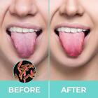 Grattoir langue propre rafraîchissant mauvaise haleine outil santé soins P39C