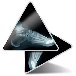 2 x Autocollants Triangle 7,5 cm - Pied Humain Cheville X-Ray Docteur #21707 - Photo 1/9