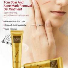 30g Acne Scar Removal Cream Pimples Stretch Marks Face Hot GEL Remove V1x4