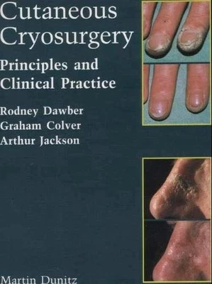 Cutaneous Cryosurgery: Principles a..., Jackson, Arthur - Image 1 of 2