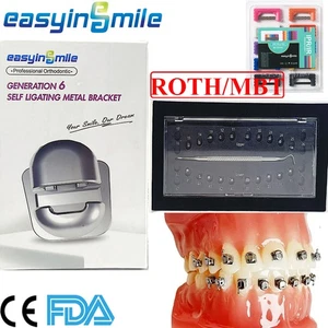 Dental Ortho Selbstligierende Brackets Kugelspange Roth MBT 022Haken/IPR Streifen - Bild 1 von 29