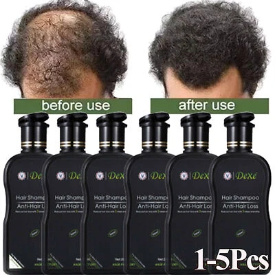 Fast Hair Growth Shampoo For Women Men Anti Hair Loss Treatment Care Thickening - Image 1 of 4