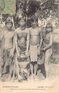 Laos - The tooth filing operation among the Khas-Kaseng - Picture 1 of 2