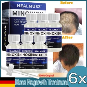 MINOXIDIL 5% Extra Strength Haarwachstum für Männer - 6 Monats-Vorrat (6 x 50ml) - Bild 1 von 18