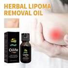 2pcs 15ml Lipoma Lump Remover Skin Repair Herbal Painless Fatty Lumps Elimin REL