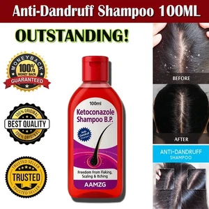 AAMZG Anti Dandruff Shampoo Shampoo for Men & Women for Flaky, Itchy, Oily 100ml - Picture 1 of 10