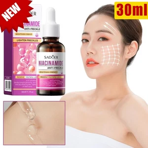 Sadoer Niacinamide Whiten Anti-Freckle Brightening Essence 30ml+ - Picture 1 of 14