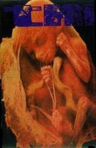 Membrana Tímpano - Demo MC #G100781 - Imagen 1 de 1