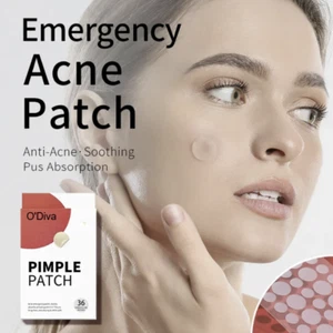 Pimple Patch (2 boxes/72 pcs) U.S Seller - Picture 1 of 9
