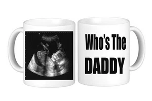 Beautiful Baby Scan Mug Your Baby Scan Image " Who's The Daddy" Present Gift - Picture 1 of 1