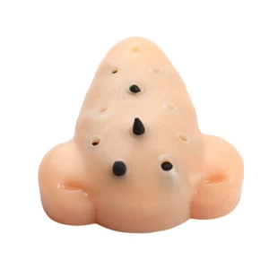 Blackhead Shape Pimple Toys Squeeze Acne Stress Relief Toys Remover Stop T.Z0 - Picture 1 of 12